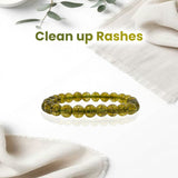 Peridot Bracelet - 8MM Clean Up Rashes