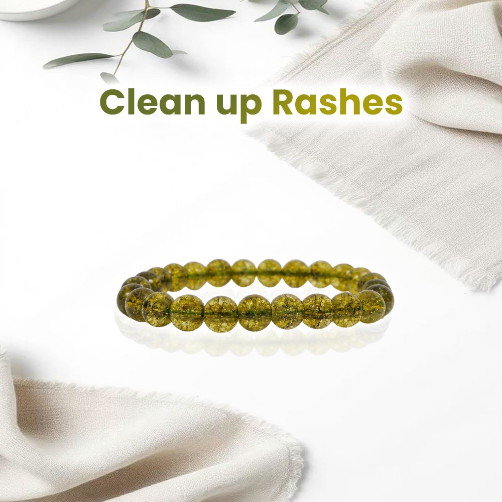 Peridot Bracelet - 8MM Clean Up Rashes